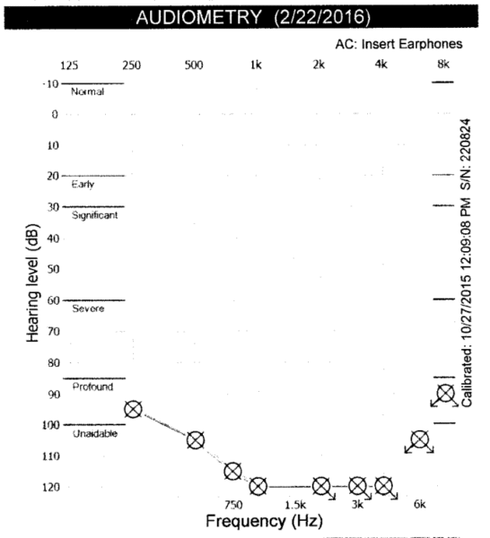 A graph depicting the results of an audiometry test